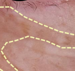 脯胺酸乙基咪唑